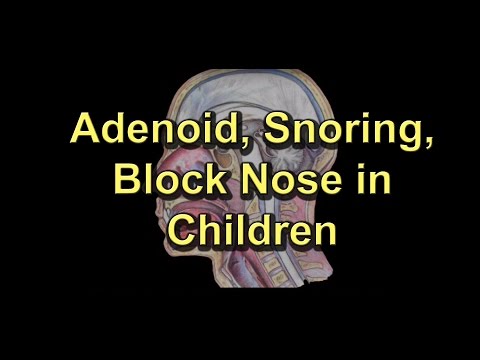 how to drain adenoids