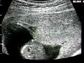 Mi Hijo, Un Lazcano Mas Mi Hijo, Un Lazcano Mas