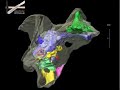 WitmerLab: Majungasaurus Braincase Morphology WitmerLab: Majungasaurus Braincase Morphology