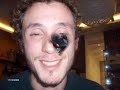 Un Bel Ragazzetto: Laurentio Ziapiana