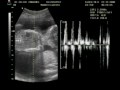 Ecografía de nuestro bebe para el mundo, Dios los bendiga