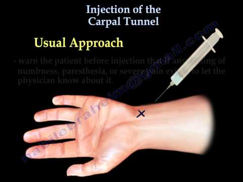 Carpal tunnel steroid injection aftercare