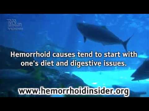 how to relieve embarrassment