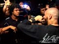 Severe Dementia - Hammer Smashed Face (Live @ Res 7)