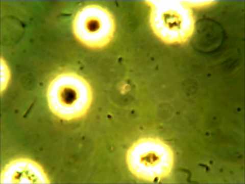 how to cure vdrl positive