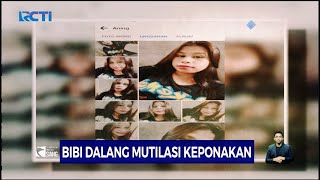 Bocah 8 Tahun Tewas Dimutilasi Pelaku Ternyata Tan