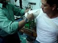 VENDAJE AMPUTACIÓN TRANSHUMERAL 2