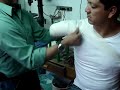 VENDAJE AMPUTACI�N TRANSHUMERAL 2