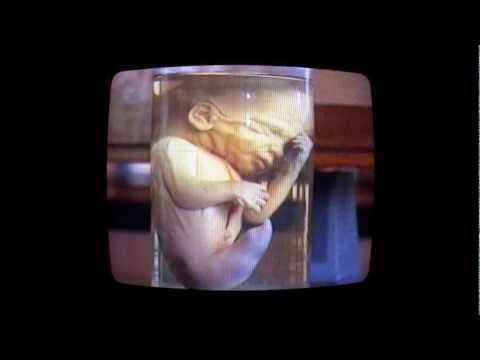 Image de prévisualisation YouTube