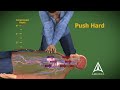 Cardiopulmonary Resuscitation - CPR - 3D Medical Animation