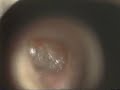 Thumbnail #1