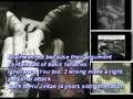 (Part 6) Trở về từ cõi sáng