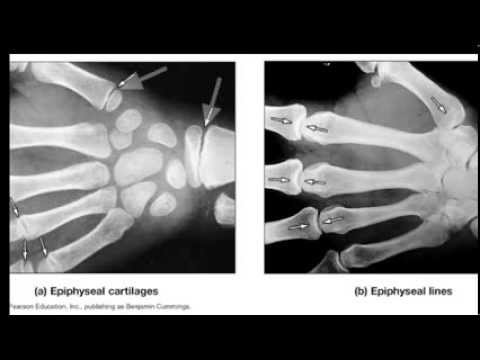 Introduction to Skeletal Tissue Video Lecture | WINNACUNNET BIOLOGY