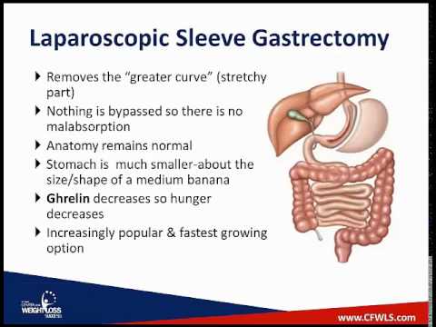 Is Weight Loss Surgery Right For You Is Weight Loss Surgery Right For You