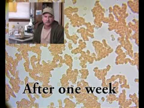 how to boost red blood cells