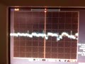 Electrocardiograma - Proyecto Final de Electrónica Aplicada