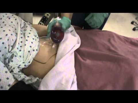 how to empty a jp drain