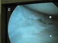 knee-surgery.html