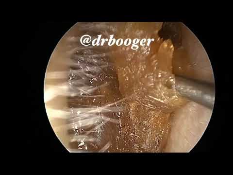 video-img