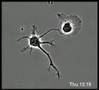 A normal neuron and a mutated neuron develop side by side.