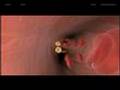 Artery Explorer