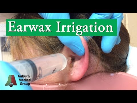 Ear Wax Irrigation – Combat Medicine 101