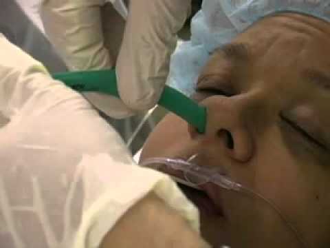 how to perform awake fiberoptic intubation