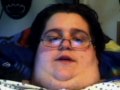 Obesity Talk 9 - Bed Sores