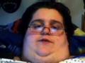 Obesity Talk 9 - Bed Sores