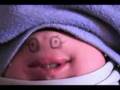 Simon's Chin Video