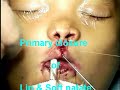 Part 1/2 Treatment protocol for clleft lip & palate cases, Clinical Pediatric Dentistry
