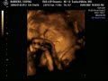 Baby Barberis