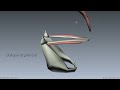 Muscles of the Larynx - Part 2 - 3D Anatomy Tutorial
