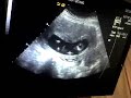 Baby Beechey