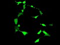 apoptosis