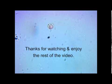 how to treat rbc morphology