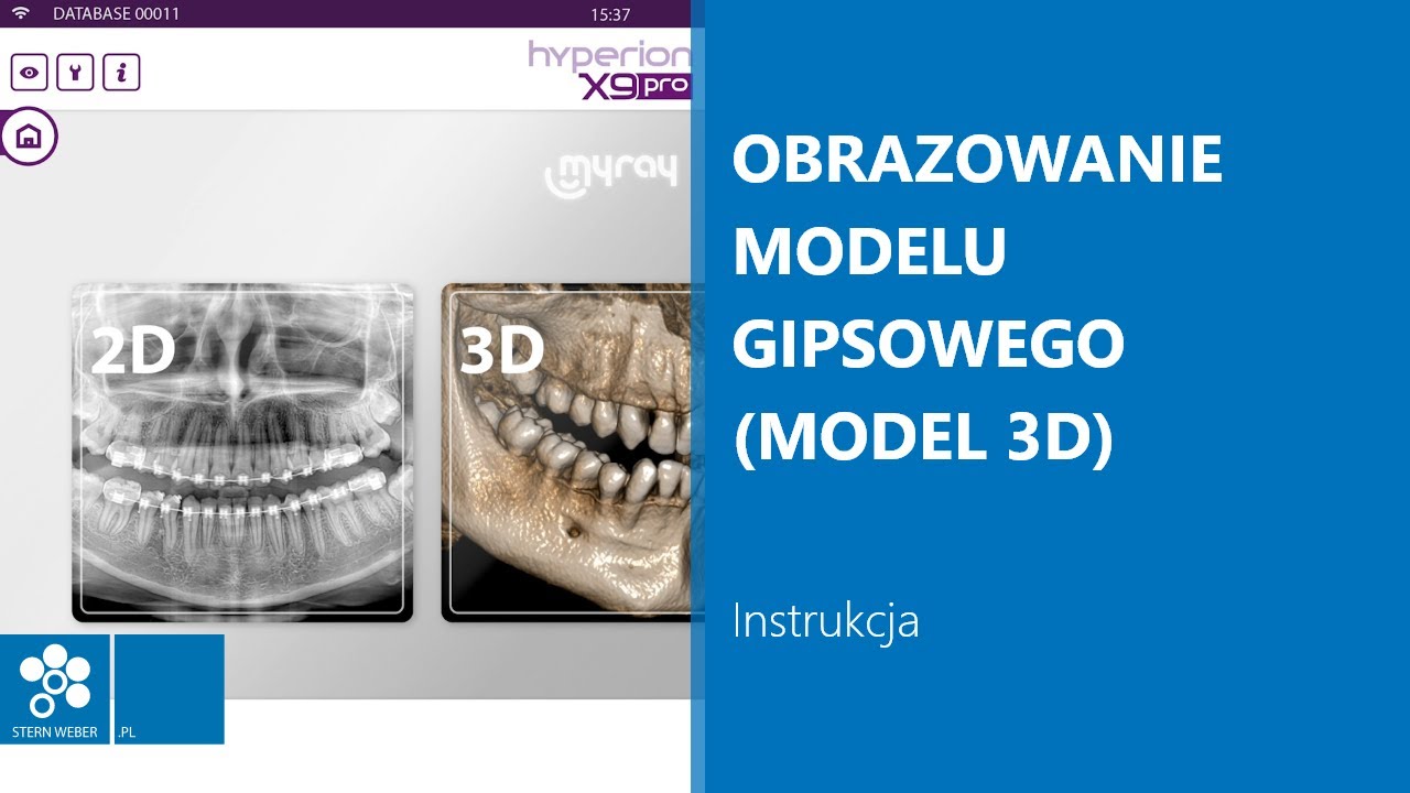 Obrazowanie modelu gipsowego (MODEL 3D) | Instrukcja wykonywania badania w MyRay Hyperion X9