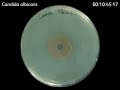 Candida albicans - Zonex