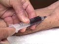 Auto-Hemoterapia - video demostraci�n (subt�tulos espa�ol)