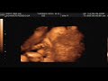 Reanna Elizabeth Jane Marie Songer\ Reanna Elizabeth Jane Marie Songer\