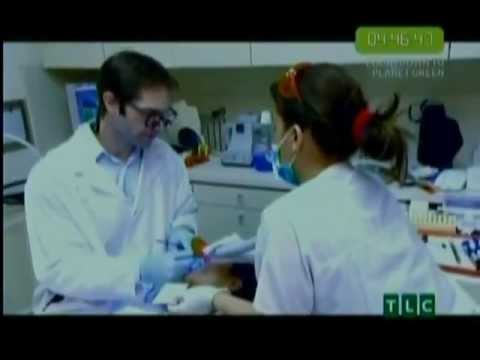 how to whiten bonding