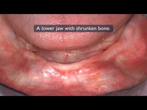See video