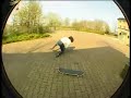 Handgelenk gebrochen