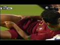 Ronaldo-s-injury-vs-