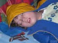 All about my two autistic girls