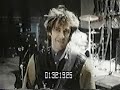  hillel slovak slovak's rig pedals effects rhcp