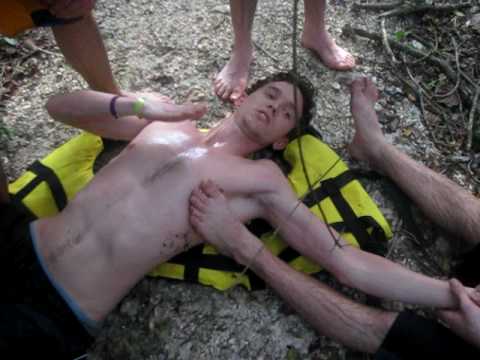 how to locate dislocated shoulder