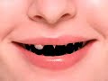 Rhythm and Teeth ???????????? Rhythm and Teeth ????????????