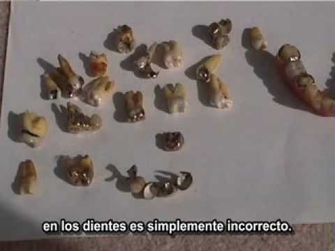 Imagen de previsualización de YouTube