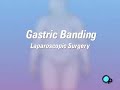 PreOp® Patient Education: Gastric Adjustable Band Surgery PreOp® Patient Education: Gastric Adjustable Band Surgery